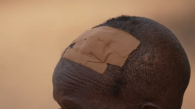 A close up of the top of someone's head with a large plaster clearly see on the top.