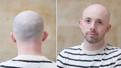 چهره مردی طاس با تی‌شرتی راه‌راه و سفید و سیاه، به دوربین نگاه می‌کند، یک گوشواره به گوش دارد