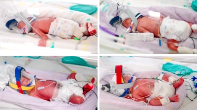 As quadrigêmeas retratados em uma montagem de quatro fotos. Estão todas na ala neonatal do hospital, em incubadoras, usando aparelhos respiratórios e com vários fios conectados.