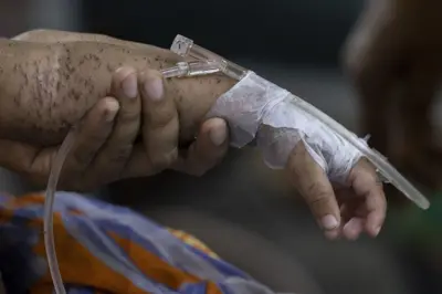 হাম আক্রান্ত শিশু