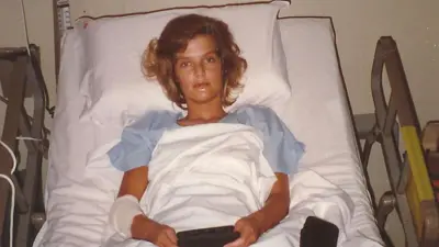 Una mujer acostada sobre una camilla con la mirada perdida y una venda en su brazo derecho sostiene un objeto indistinguible en sus manos