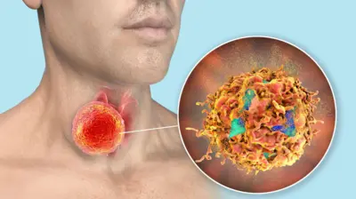 ਥਾਇਰਾਇਡ