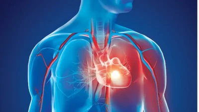 Ciwon zuciya na kashe miliyoyin mutane a duniya