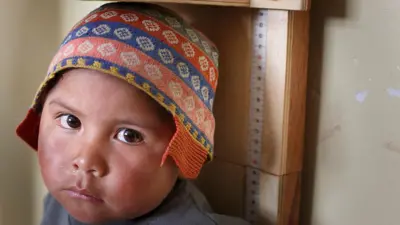 قد کودکی نوپا در ماه اپریل ۲۰۱۶ در یک مرکز صحی در روستای توارچاپی در بولیوی اندازه‌گیری می‌شود. این پسر یک کلاه پشمی نقش‌دار سرخ، آبی، زرد و سفید بر سر دارد و به دوربین خیره شده است. در سمت راست سر او، یک متر اندازه‌گیری دیده می‌شود. 