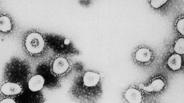 Coronavirus: El Caso Del Hombre Con Superanticuerpos Contra La Covid-19 ...