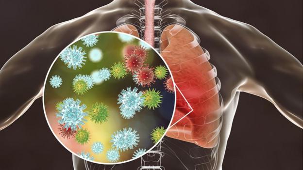 Coronavirus | "Un Enemigo Increíblemente Astuto": Por Qué El Virus Que ...