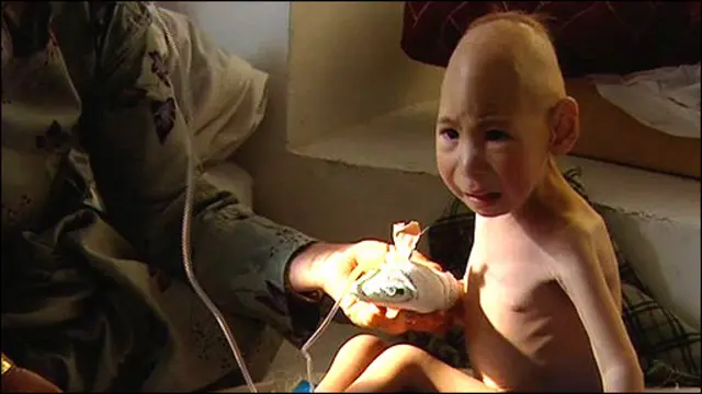 بر اساس آمار وزارت بهداشت افغانستان، بیش از پنجاه درصد کودکان افغان از اختلال در رشد رنج میبرند