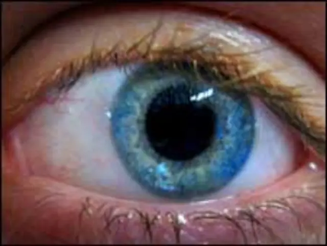 ران کو چند ماہ قبل تجرباتی بنیادوں پر مشینی آنکھ لگائی گئی تھی