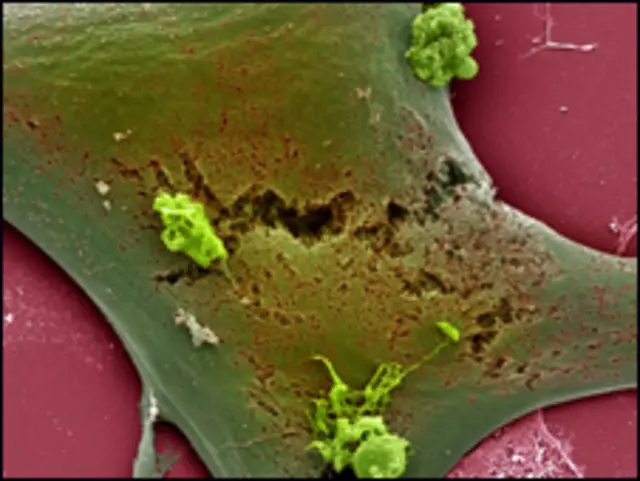 स्टेम सेल