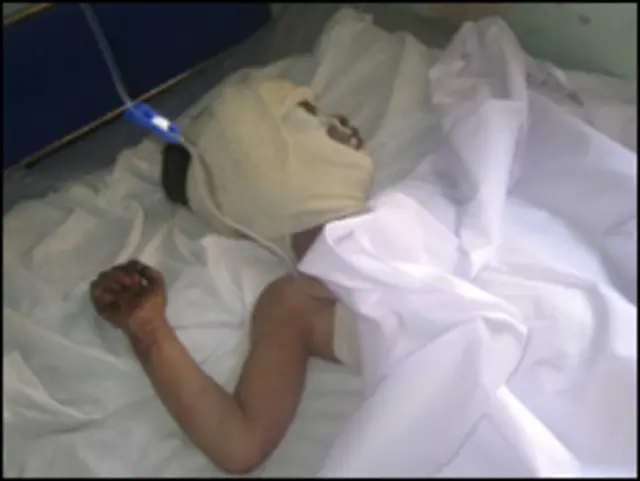 حملوں میں عام شہری ہلاک و زخمی ہوئے