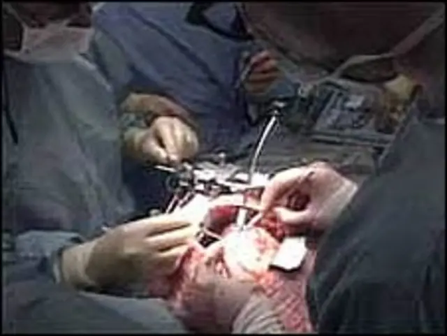 Cirugía cardiovascular