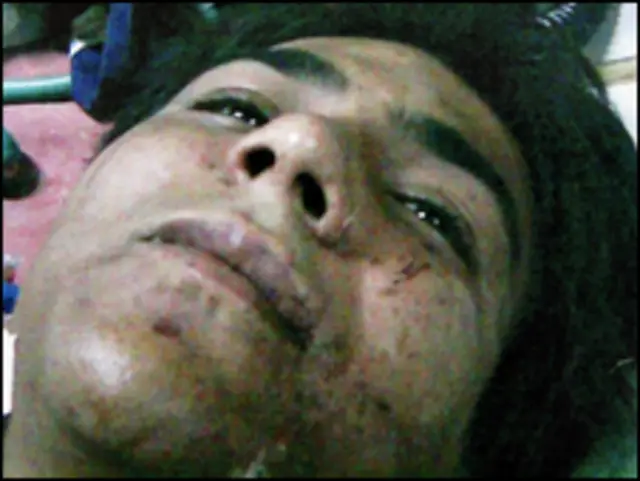 अजमल क़साब 