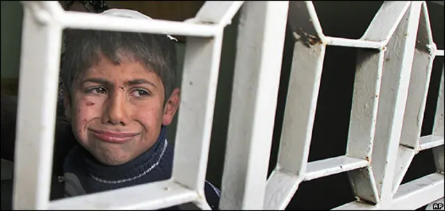 Niño palestino herido durante la ofensiva israelí en Gaza a principios de este año