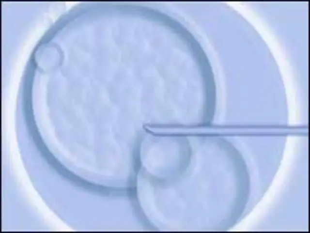 sistem IVF
