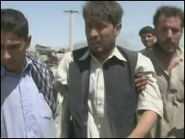 دھماکے میں زخمی ہونے والا شخص