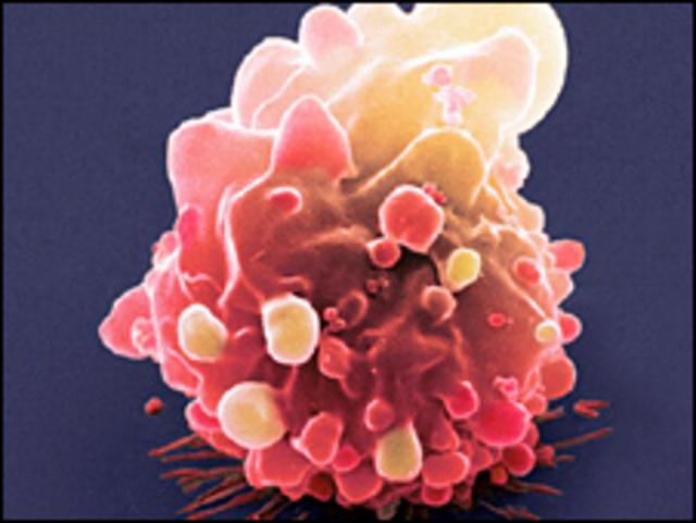 Célula cancerosa de colon
