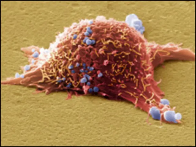 клетка меланомы