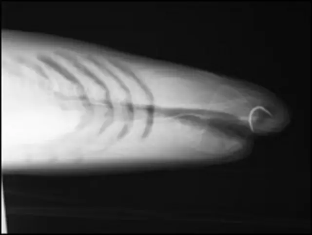 Ultrassom de Florence