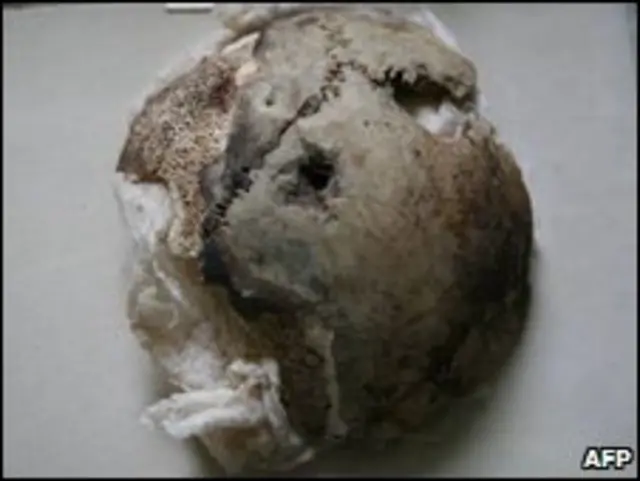 Фрагмент черепа, предположительно принадлежащий Гитлеру