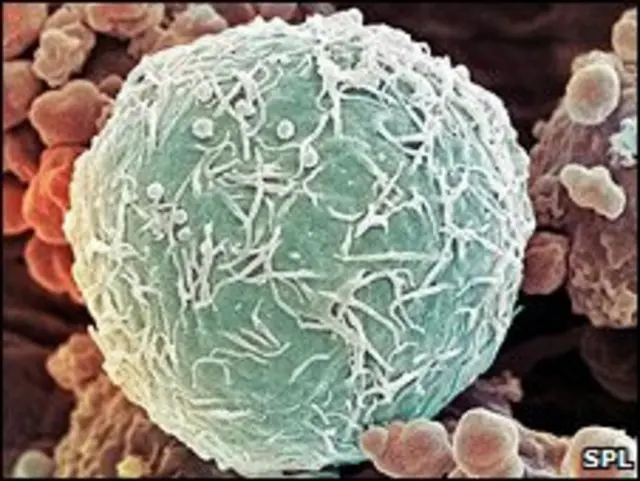 Раковые клетки