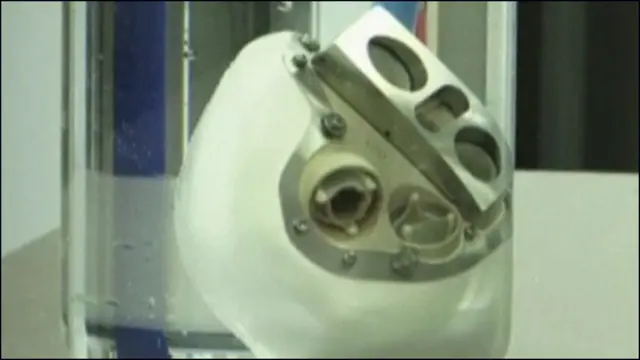 ڈاکٹر بارنی کلارک پہلے شخص تھے جن کے سینے میں 1982 میں مصنوعی دل گایا گیا تھا