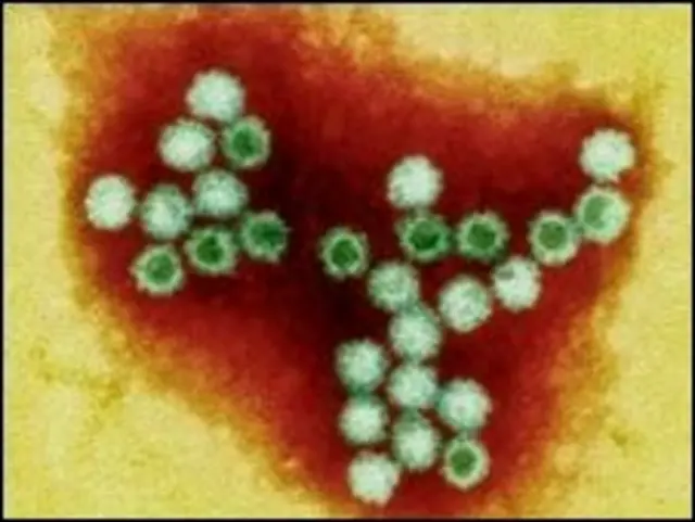Norovirus