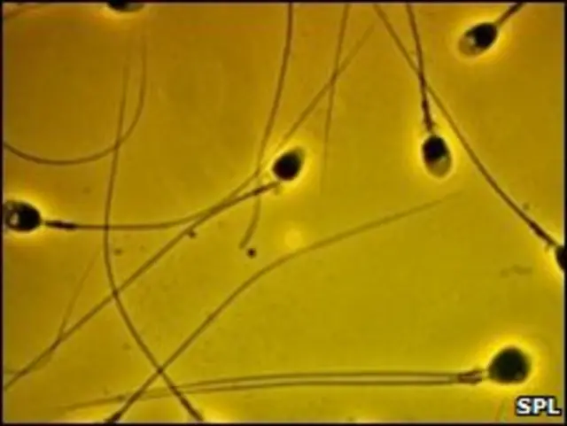 حيوانات منوية