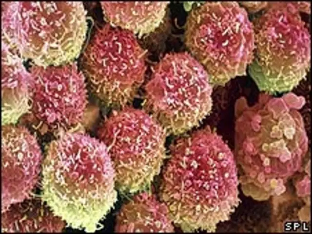 Клетки рака лёгких