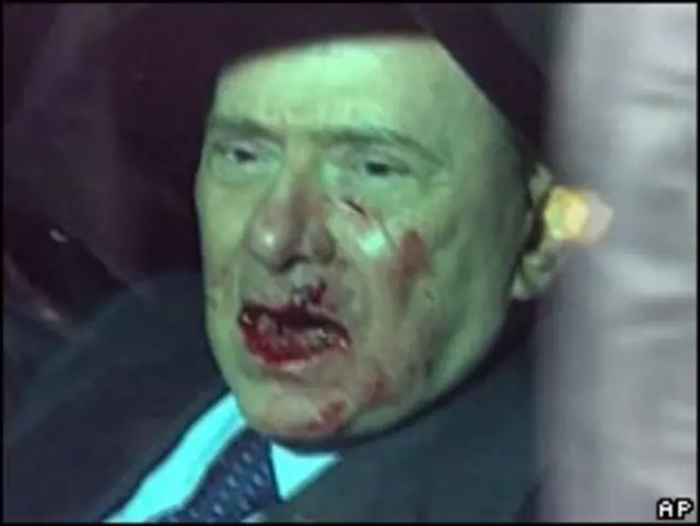 贝卢斯科尼遇袭后乘车离开现场（13/12/2009）