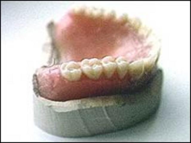 Cómo funciona el adhesivo para dentaduras postizas