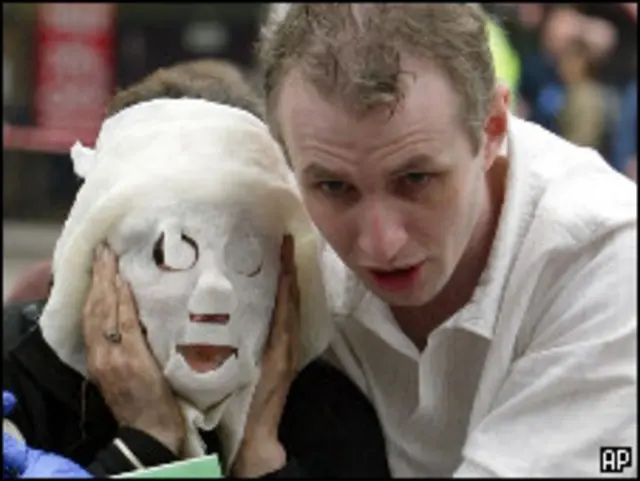 Врач с женщиной, пострадавшей во время взрыва в 2005 году