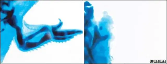 نقص عضو ناشی از تالیدومید