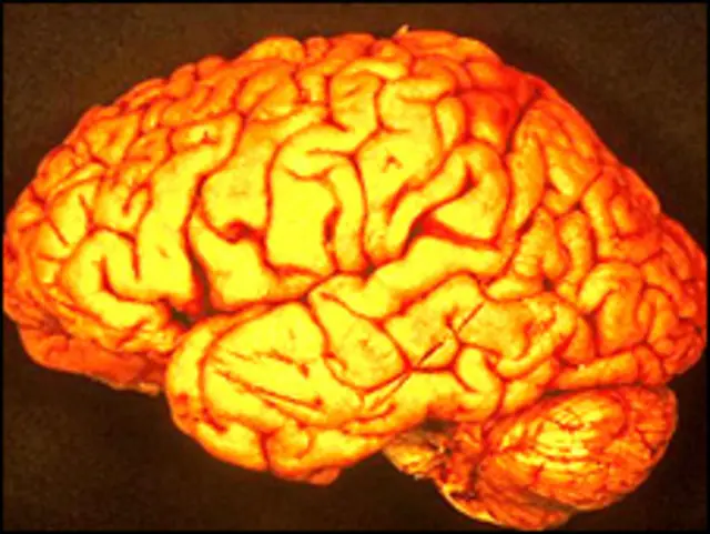 Мозок дає команду різним ділянкам виконувати різні задачі