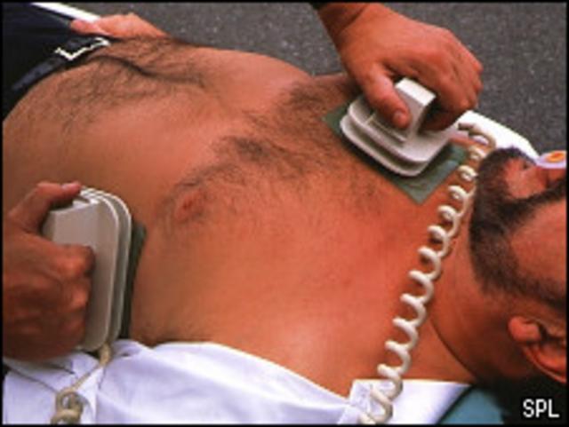 Иногда пациенты рассказывают, что во время клинической смерти видели себя со стороны