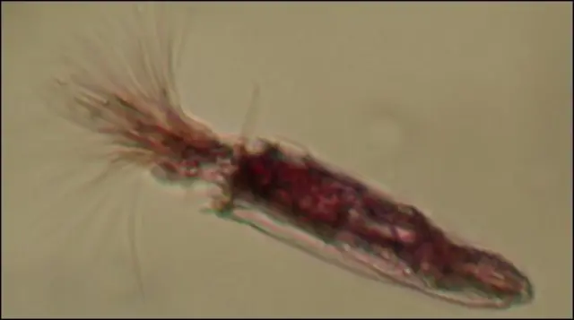 Loricífero descubierto en L'Atalante (Roberto Danovaro)