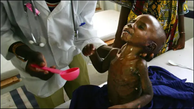 Bencana kelaparan Afrika