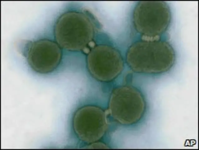 خلايا مصبوغة