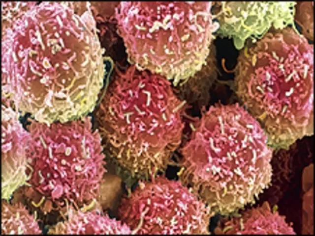 Células cancerosas