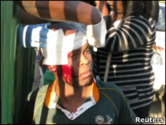 Ferido recebe tratamento do lado de fora do estádio