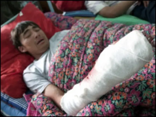 احد ضحايا العنف الاثني في قرغيزستان