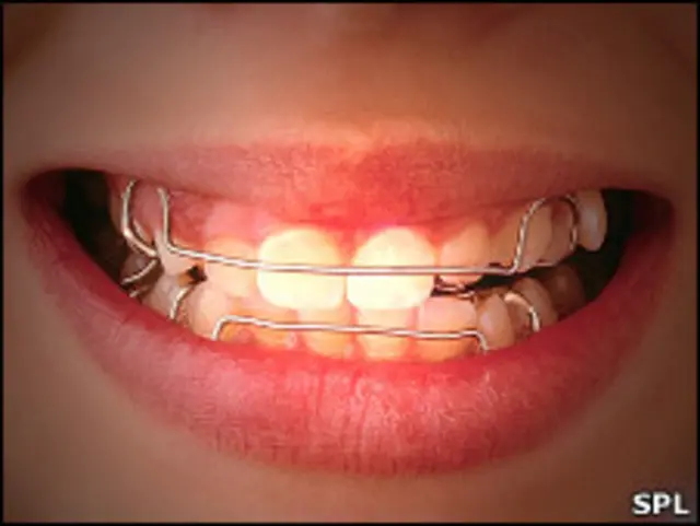 девочки mouth