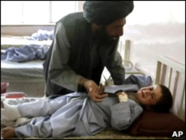 طفل جريح في انفجار في افغانستان