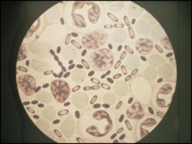 Bacteria que causa la peste bubónica (Foto:SLP)