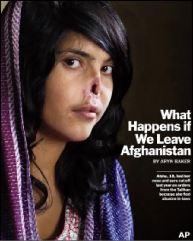 عایشه می گوید بزرگترین آرزویش این است که بینی از دست رفته اش را باز یابد