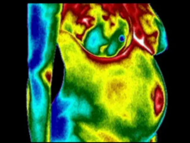 गर्भवती महिला