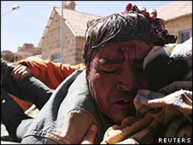 Minero herido en Potosí.