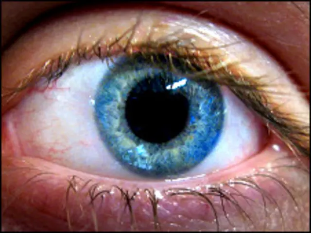 Ojo