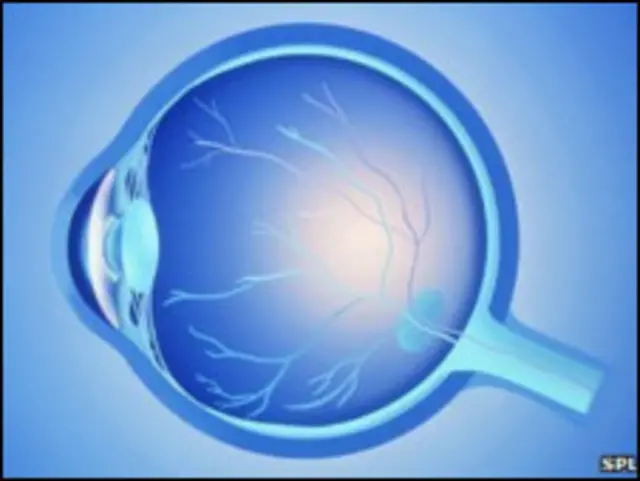 Ojo