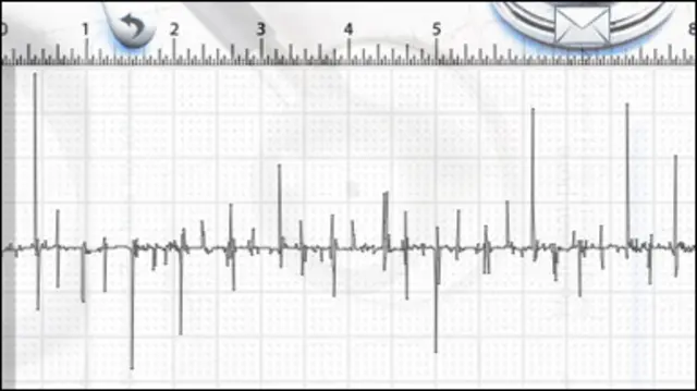 Iphone stetoskop uygulaması