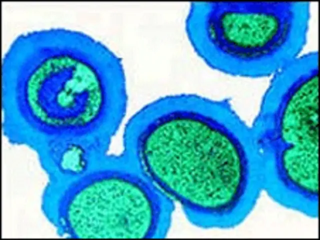 Estafilococo dorado resistente a la meticilina